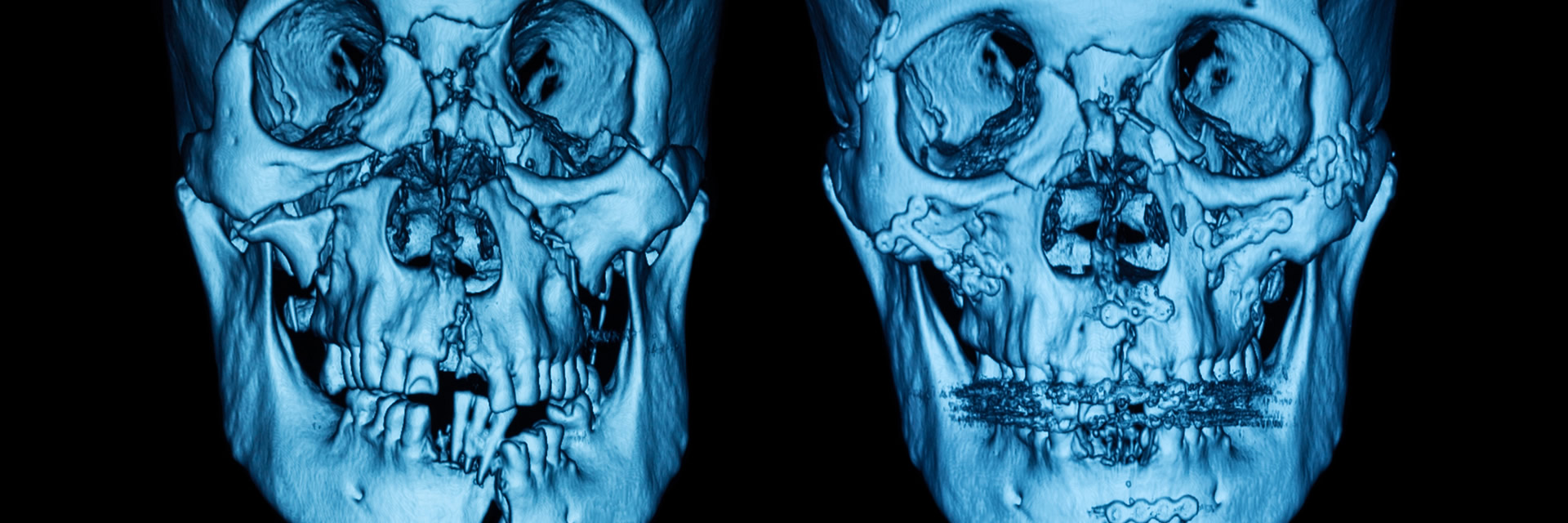 West Hollywood Facial Trauma Treatment Specialist Maxillofacial